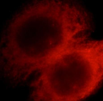 STX8 Rabbit Polyclonal Antibody