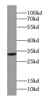 SDCBP Rabbit Polyclonal Antibody