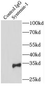 SDCBP Rabbit Polyclonal Antibody