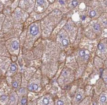 SDCBP Rabbit Polyclonal Antibody