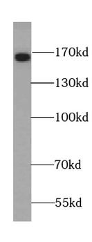 TNR Rabbit Polyclonal Antibody