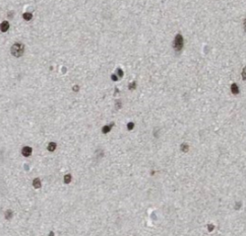 TNR Rabbit Polyclonal Antibody