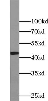 TGFB2 Specific Rabbit Polyclonal Antibody