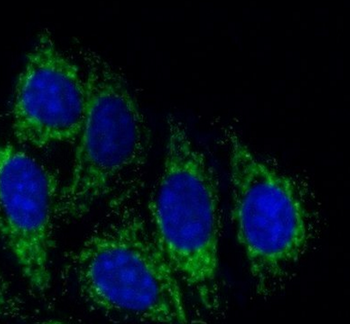 TGFB2 Specific Rabbit Polyclonal Antibody