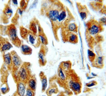 TGFB2 Specific Rabbit Polyclonal Antibody