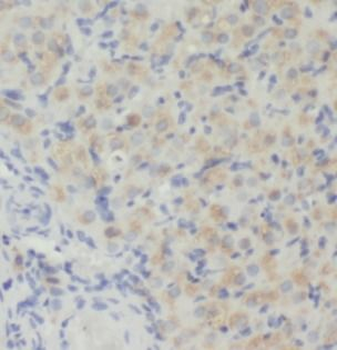 TGFB3 Rabbit Polyclonal Antibody