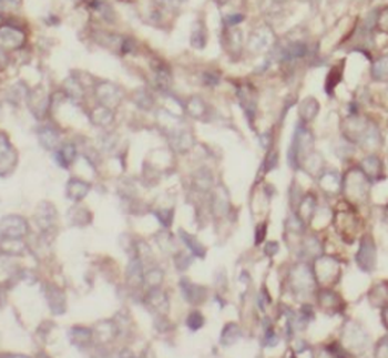 TNFAIP1 Mouse Monoclonal Antibody