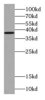 TOMM40 Rabbit Polyclonal Antibody