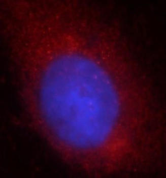 TOMM40 Rabbit Polyclonal Antibody