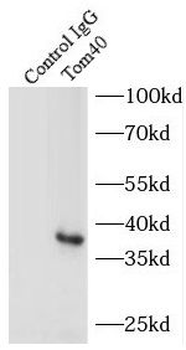TOMM40 Rabbit Polyclonal Antibody