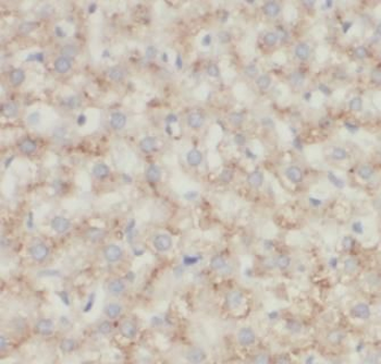 TOMM40 Rabbit Polyclonal Antibody