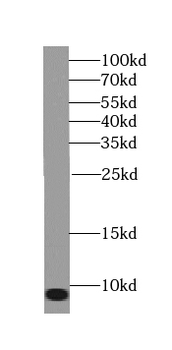 TOMM6 Rabbit Polyclonal Antibody