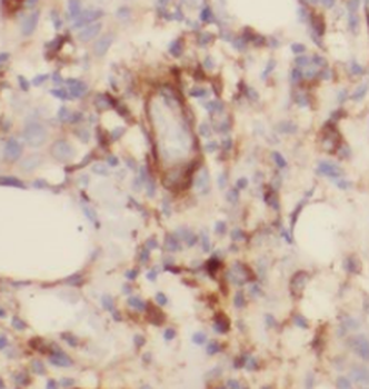 TOMM6 Rabbit Polyclonal Antibody