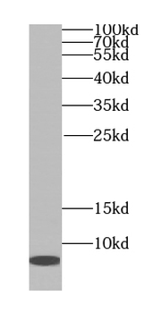 TOMM7 Rabbit Polyclonal Antibody