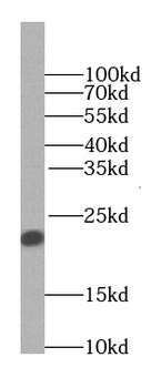 TAGLN2 specific Rabbit Polyclonal Antibody