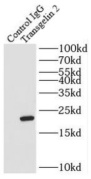 TAGLN2 specific Rabbit Polyclonal Antibody