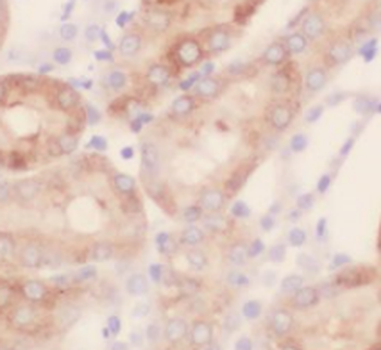 TAGLN2 specific Rabbit Polyclonal Antibody