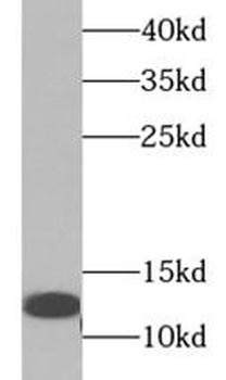 TFF1 Rabbit Polyclonal Antibody