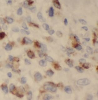TFF1 Rabbit Polyclonal Antibody