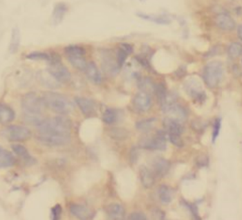 TRPC4AP Mouse Monoclonal Antibody