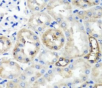 TNFAIP6 Rabbit Polyclonal Antibody