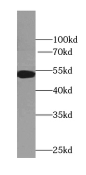 TTC7B Rabbit Polyclonal Antibody