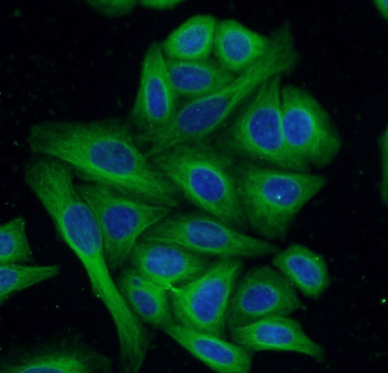 Beta Tubulin Mouse Monoclonal Antibody
