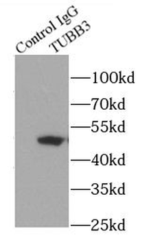 Beta Tubulin Mouse Monoclonal Antibody