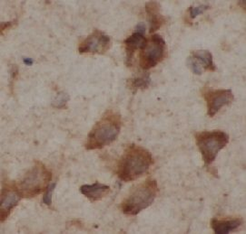 Beta Tubulin Mouse Monoclonal Antibody