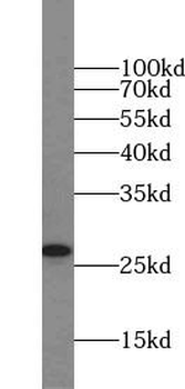 TWIST1 specific Rabbit Polyclonal Antibody