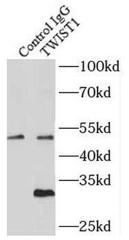 TWIST1 specific Rabbit Polyclonal Antibody