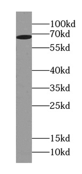 UBASH3A Specific Rabbit Polyclonal Antibody