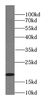 UBE2I Specific Rabbit Polyclonal Antibody