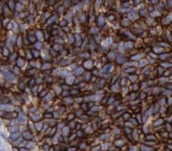 UBE2I Specific Rabbit Polyclonal Antibody