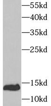 UBE2D1 Rabbit Polyclonal Antibody