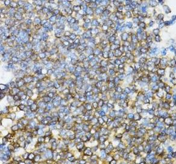UBE2D1 Rabbit Polyclonal Antibody