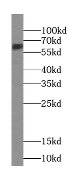 UNC5D Specific Rabbit Polyclonal Antibody
