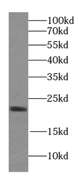 HPCAL1 Rabbit Polyclonal Antibody