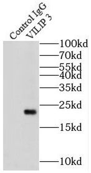HPCAL1 Rabbit Polyclonal Antibody