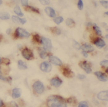 HPCAL1 Rabbit Polyclonal Antibody