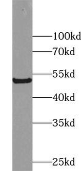 Vitamin D binding protein Mouse Monoclonal Antibody