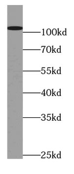 PIK3C3 Rabbit Polyclonal Antibody