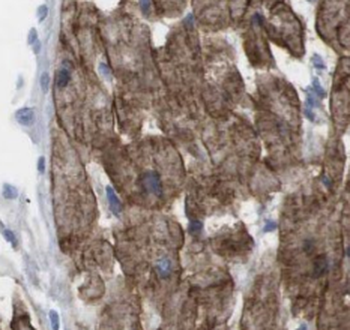 PIK3C3 Rabbit Polyclonal Antibody