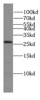 LAT2 Rabbit Polyclonal Antibody