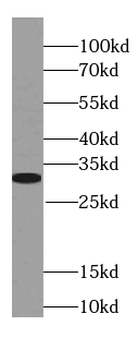 NHEJ1 Rabbit Polyclonal Antibody