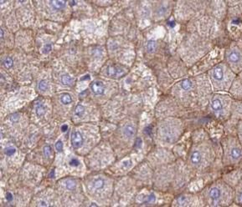 SLC39A4 Rabbit Polyclonal Antibody