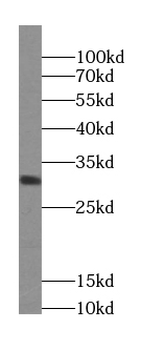 ZNRF2 Specific Rabbit Polyclonal Antibody