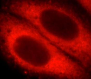 YWHAQ Rabbit Polyclonal Antibody