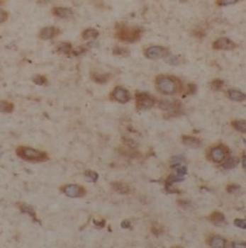YWHAQ Rabbit Polyclonal Antibody