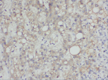 YWHAE Rabbit Polyclonal Antibody